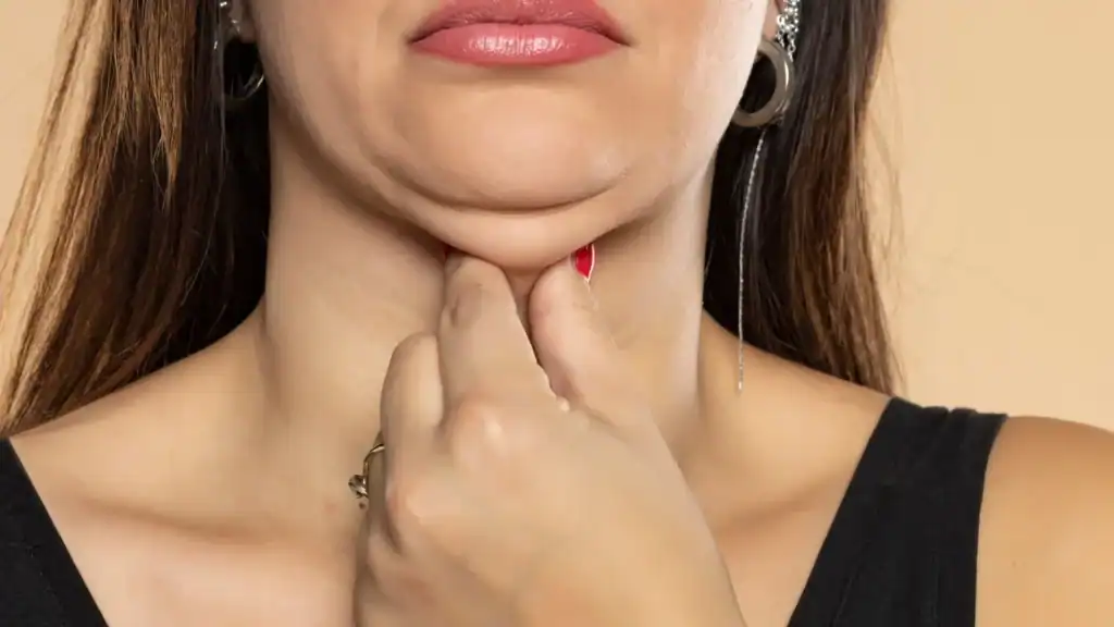 An image of a woman with double chin, sad, worried : Non Surgical Double Chin Removal Treatment in Stanford le Hope, UK