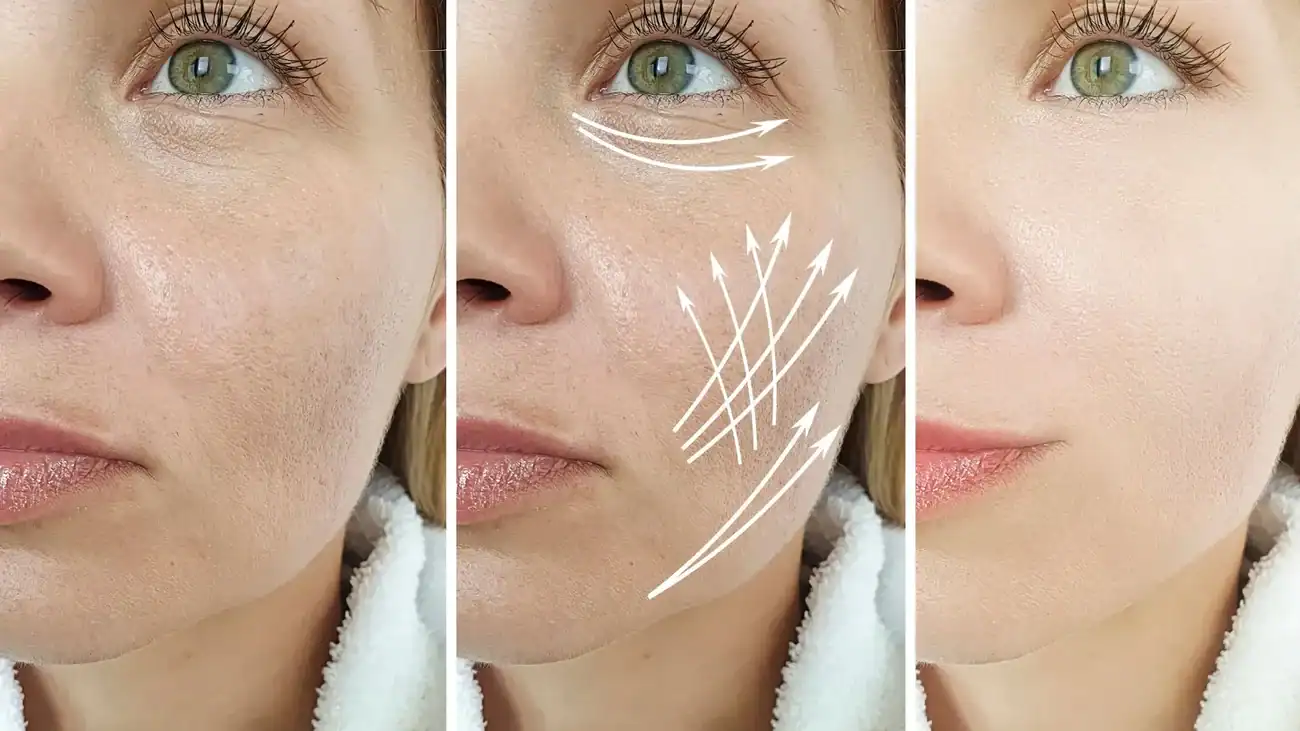 Can One Treatment Really Tackle More Than One Skin Concern Stanford le Hope?