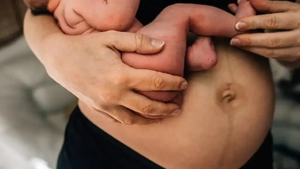 Why Is My Stomach Still Big After Pregnancy Stanford le Hope?